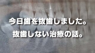 今日歯を抜歯しました。 抜歯しない治療の話。